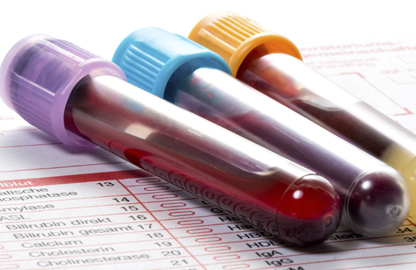 Blood Based Tests & Markers aohc attch3