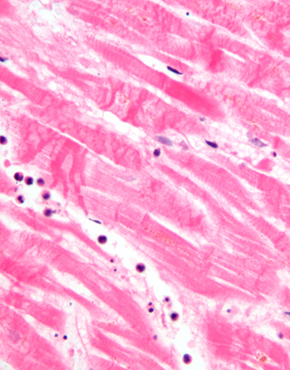 Histopathology attch 1