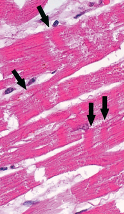 Histopathology attch 3