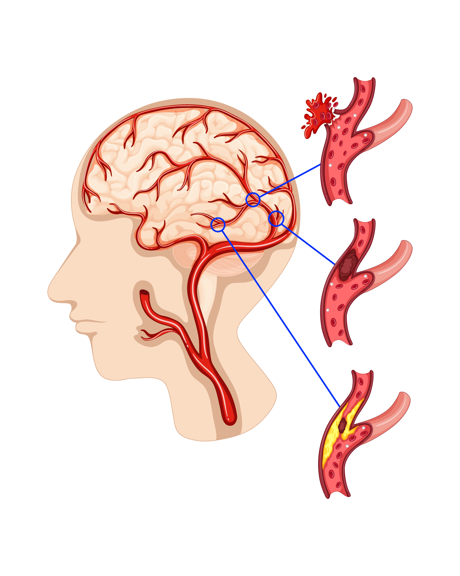 Causes and Risk Factors of Head and neck Cancer-01