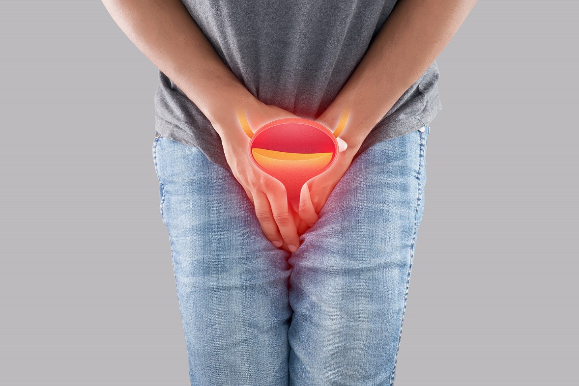 A man having urethritis and Urinary Incontinence. Male with hands holding her crotch. Cystitis symptoms with men